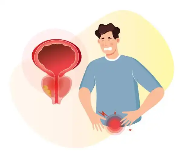 Prostate enlargement / Benign prostatic hyperplasia