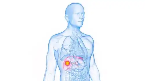 Liver Cancer Treatment
